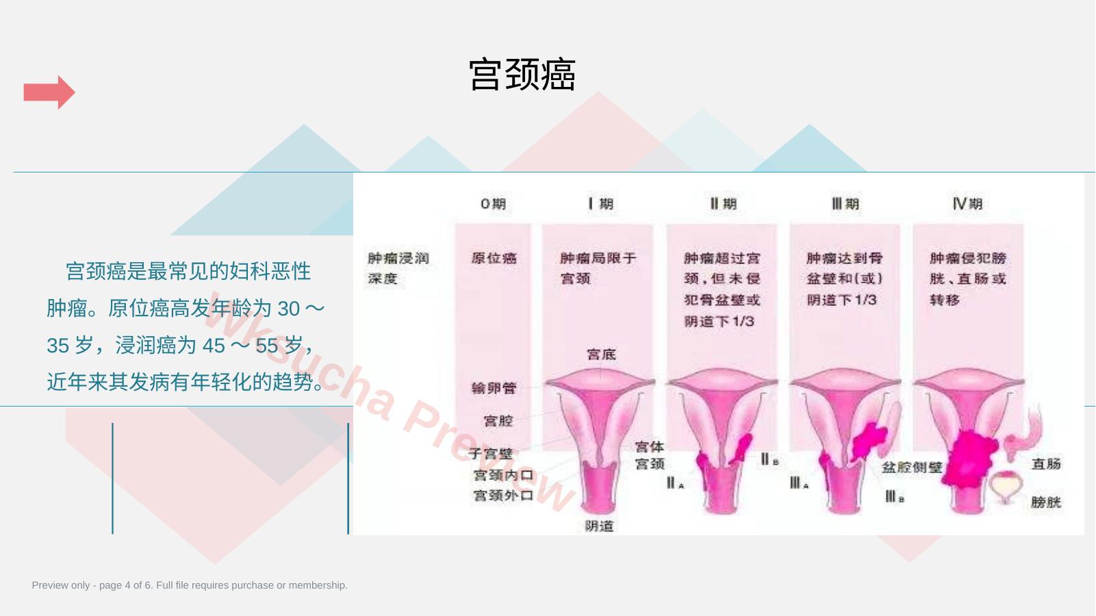 预览第 4 页