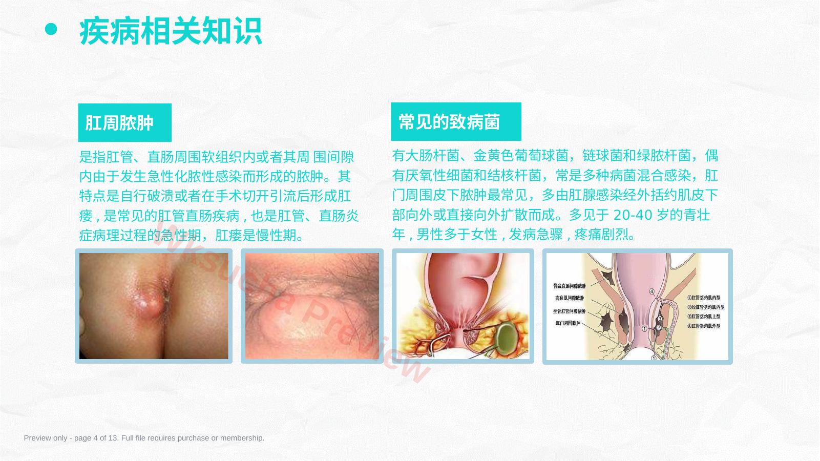 预览第 4 页