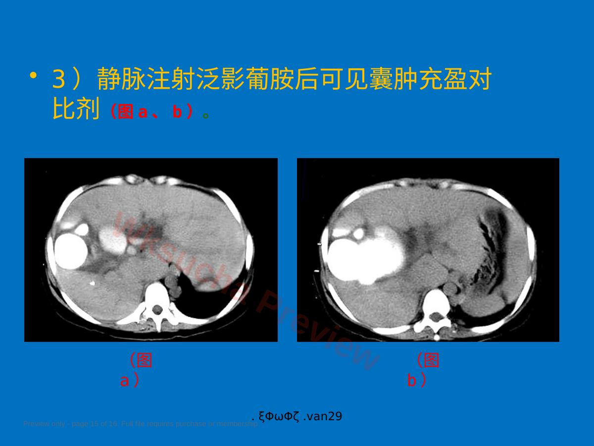 预览第 15 页