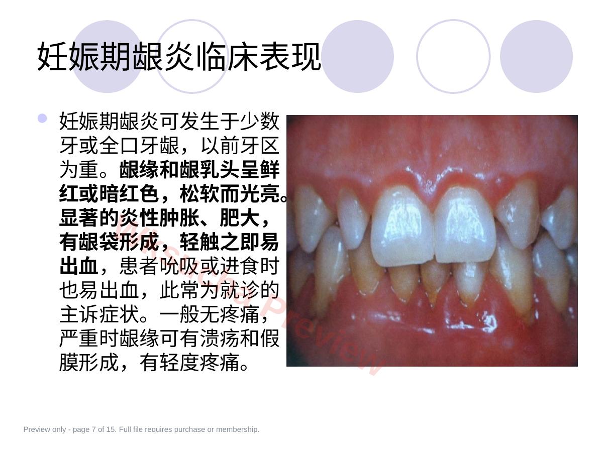 预览第 7 页