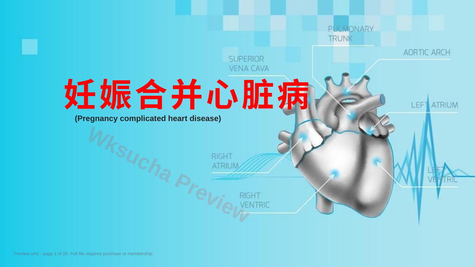 妊娠合并心脏病经典课件