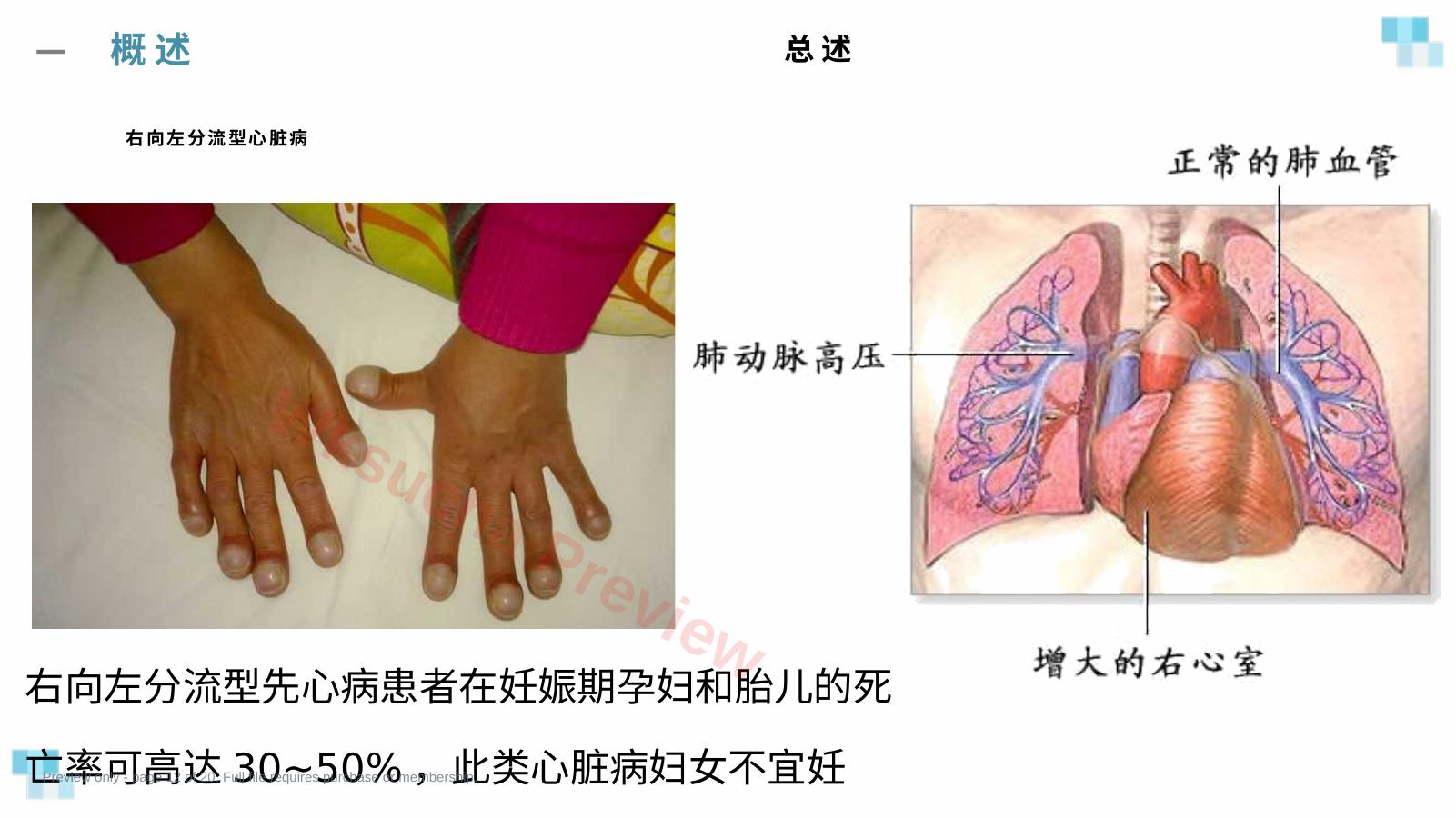 预览第 12 页