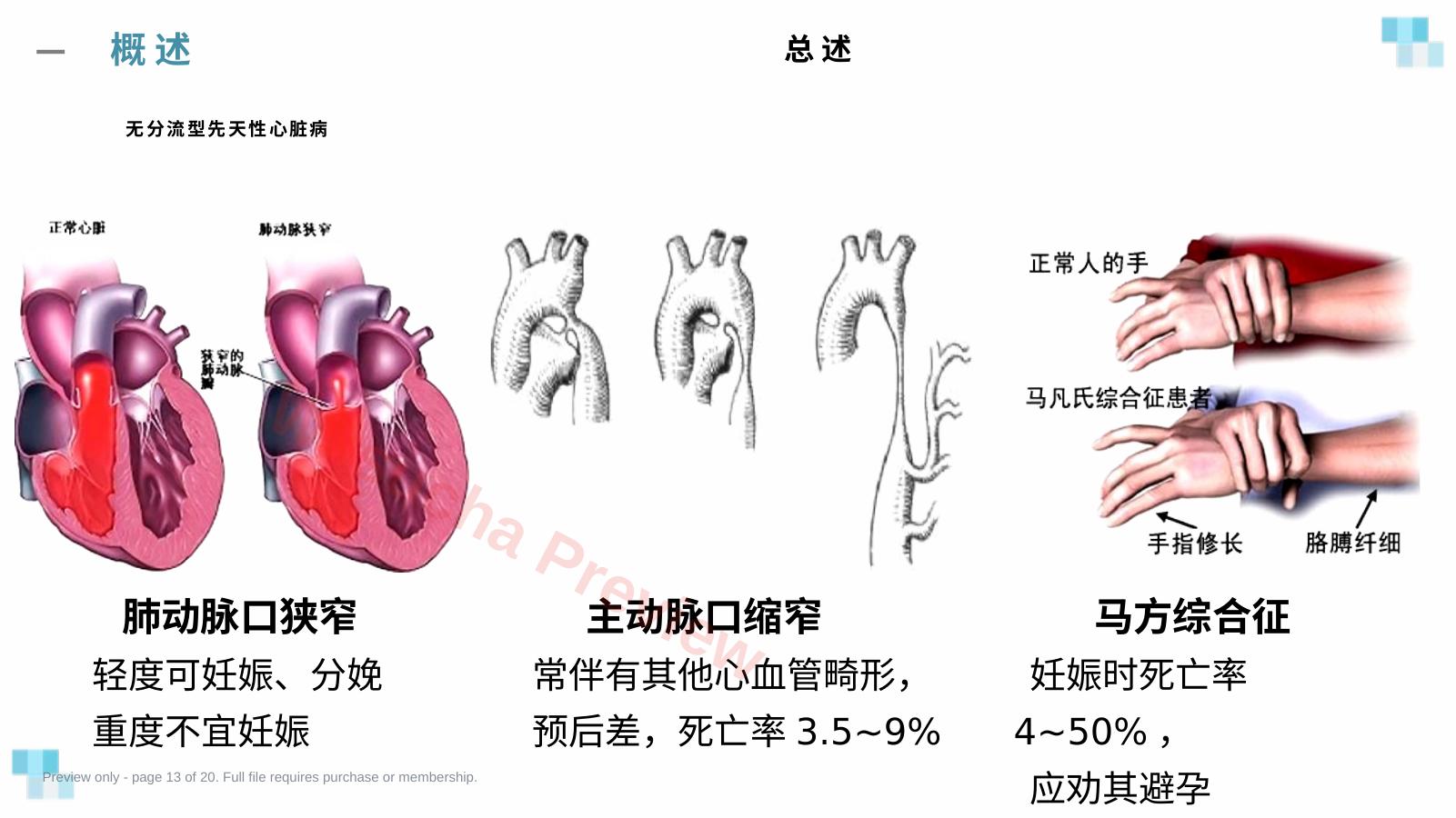 预览第 13 页