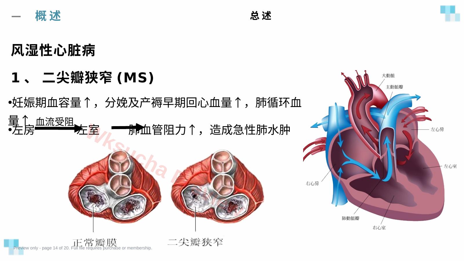 预览第 14 页