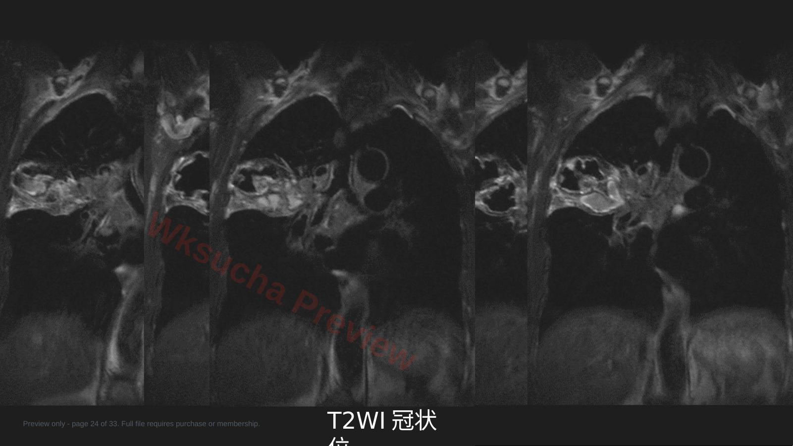 预览第 24 页