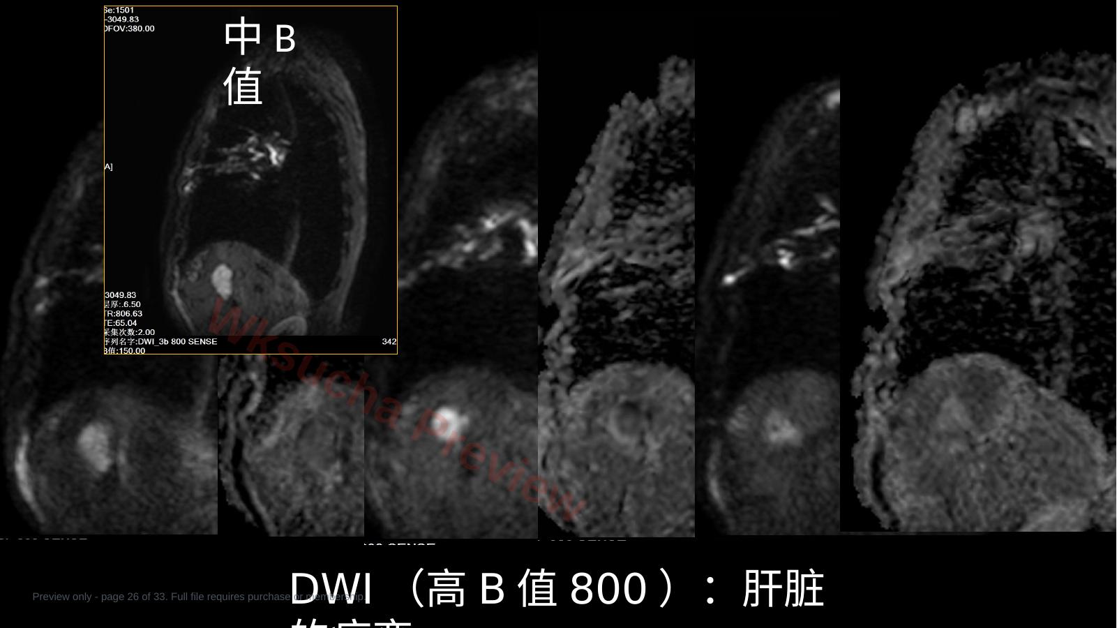 预览第 26 页