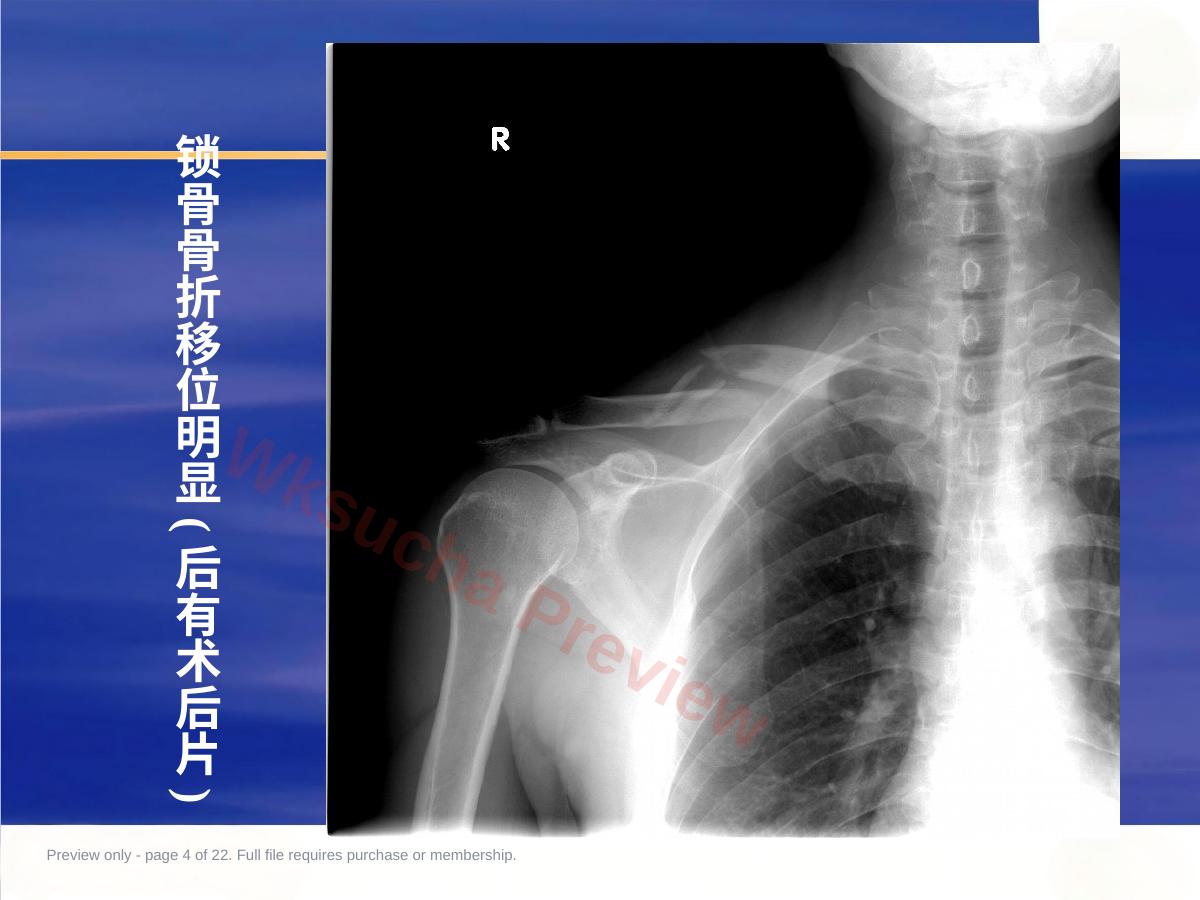 预览第 4 页