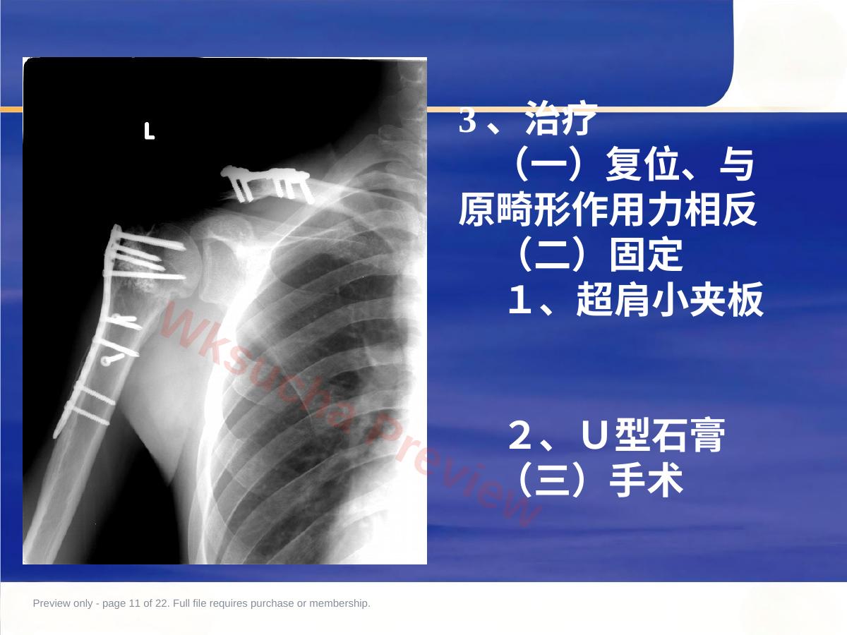 预览第 11 页