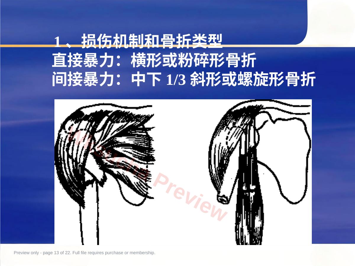 预览第 13 页