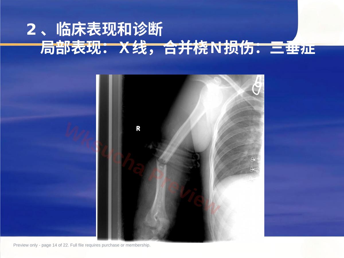 预览第 14 页