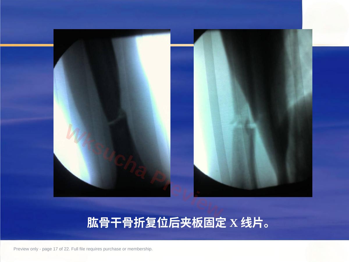 预览第 17 页