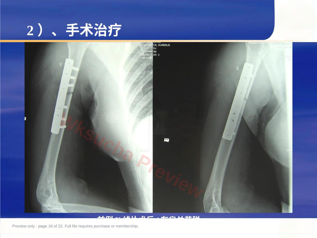 预览第 18 页