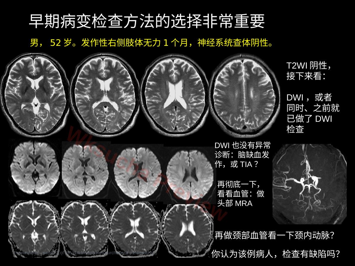预览第 22 页