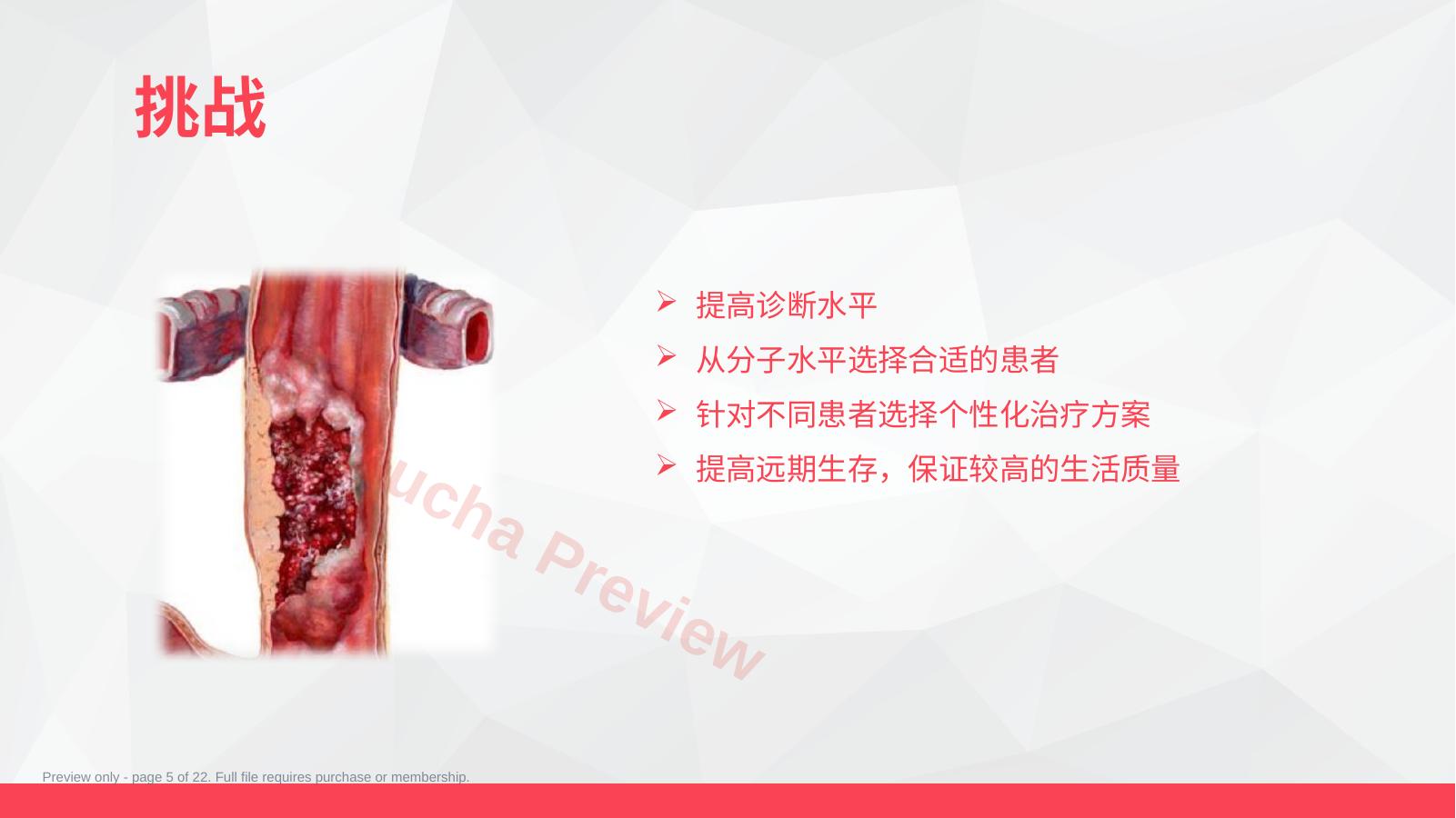 预览第 5 页