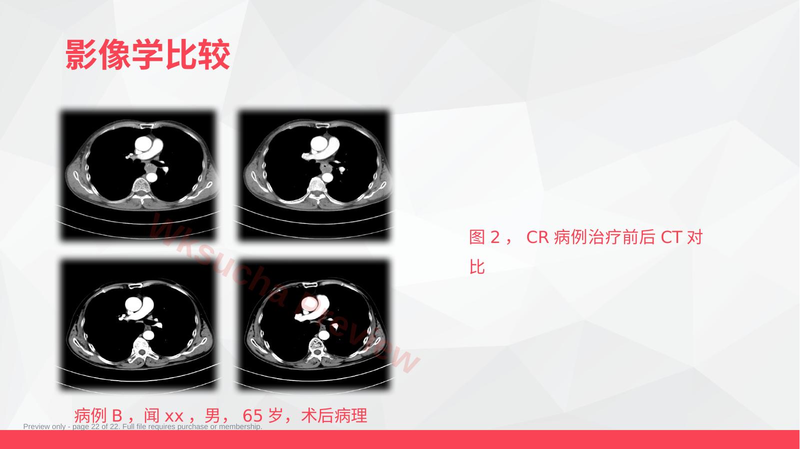 预览第 22 页