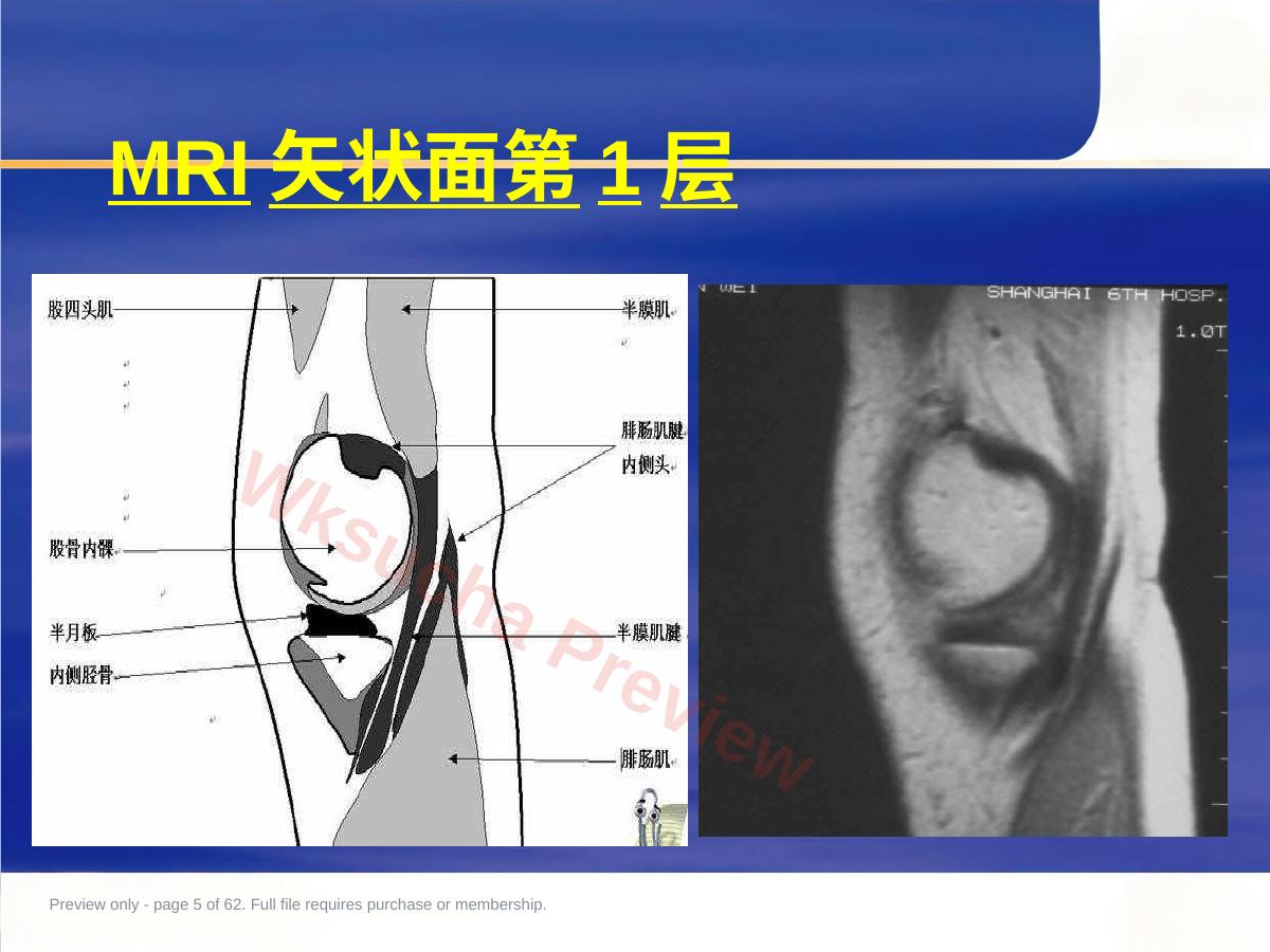预览第 5 页