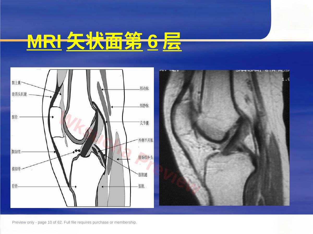 预览第 10 页