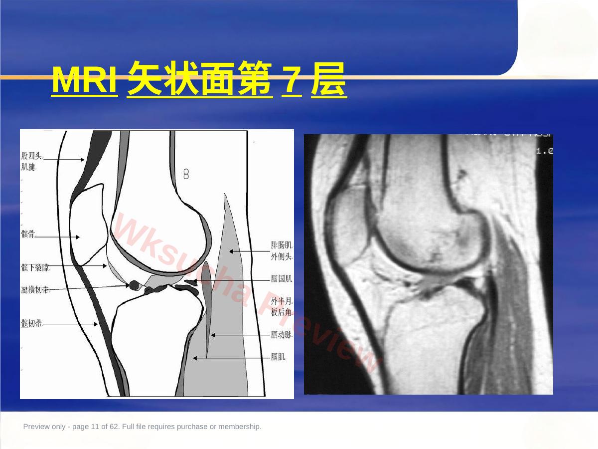 预览第 11 页