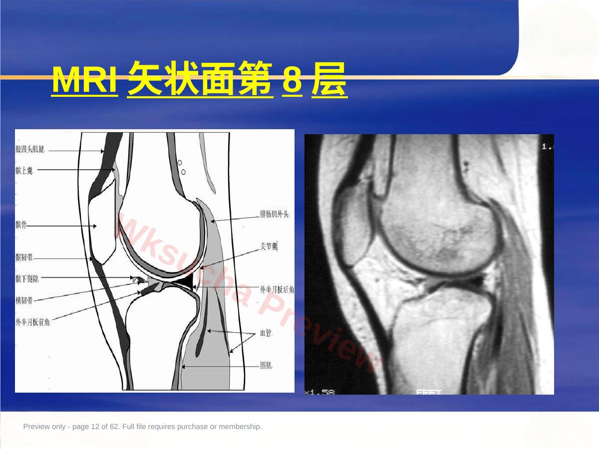 预览第 12 页