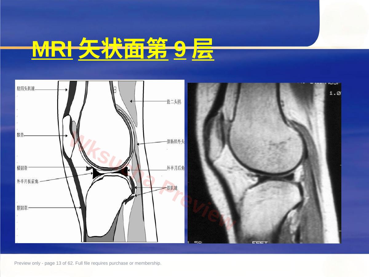 预览第 13 页