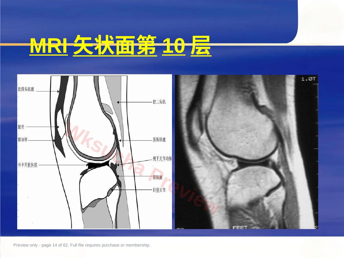 预览第 14 页