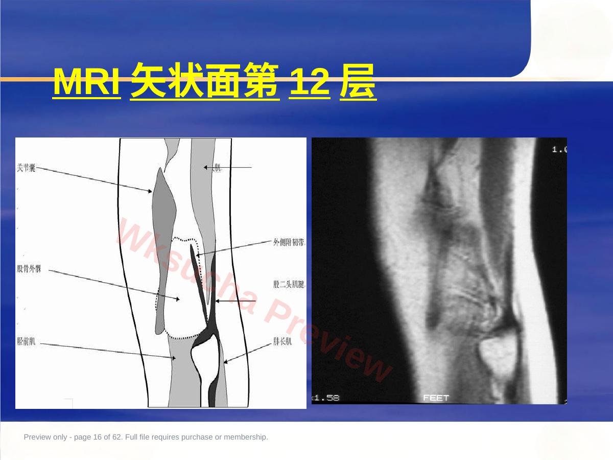 预览第 16 页