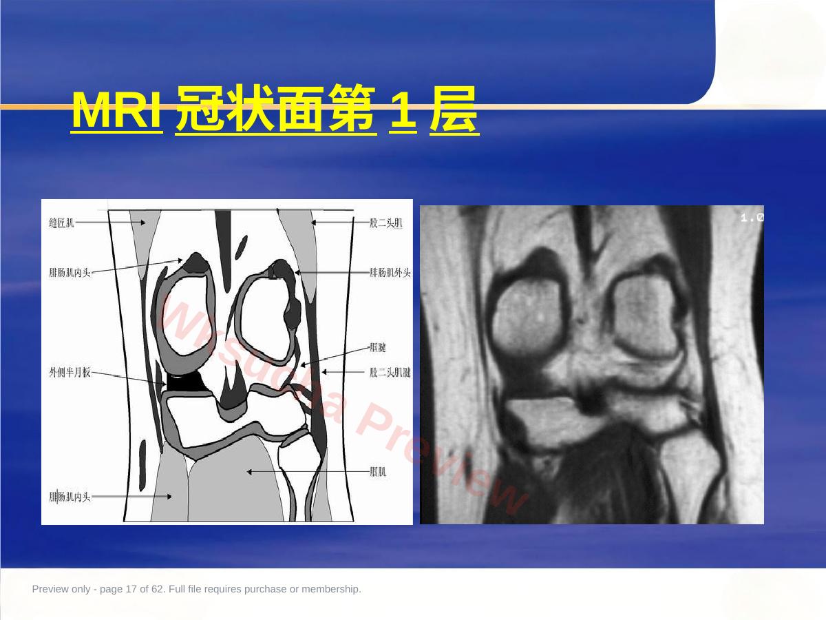 预览第 17 页