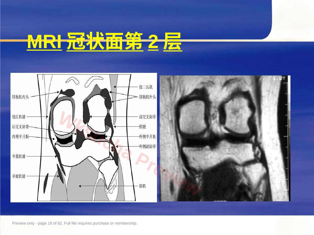 预览第 18 页