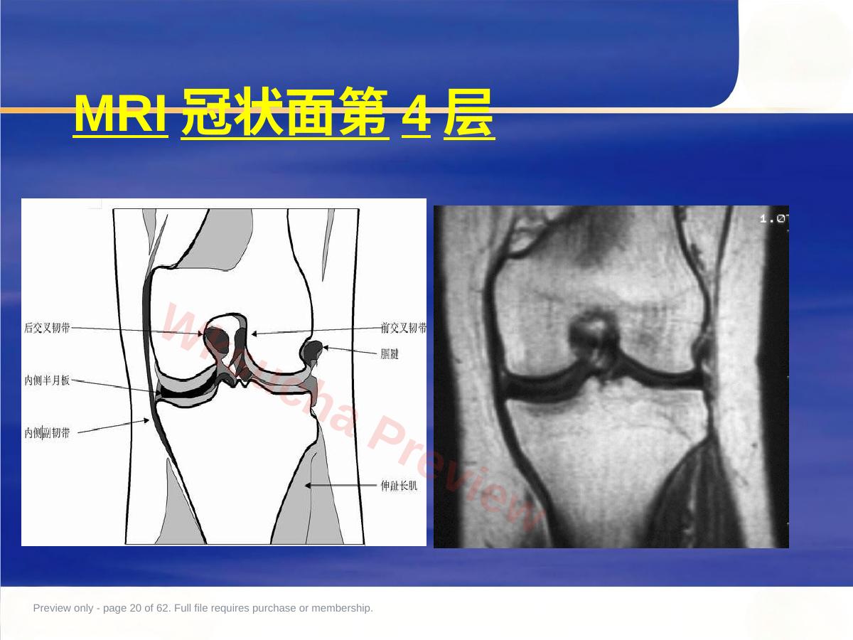 预览第 20 页
