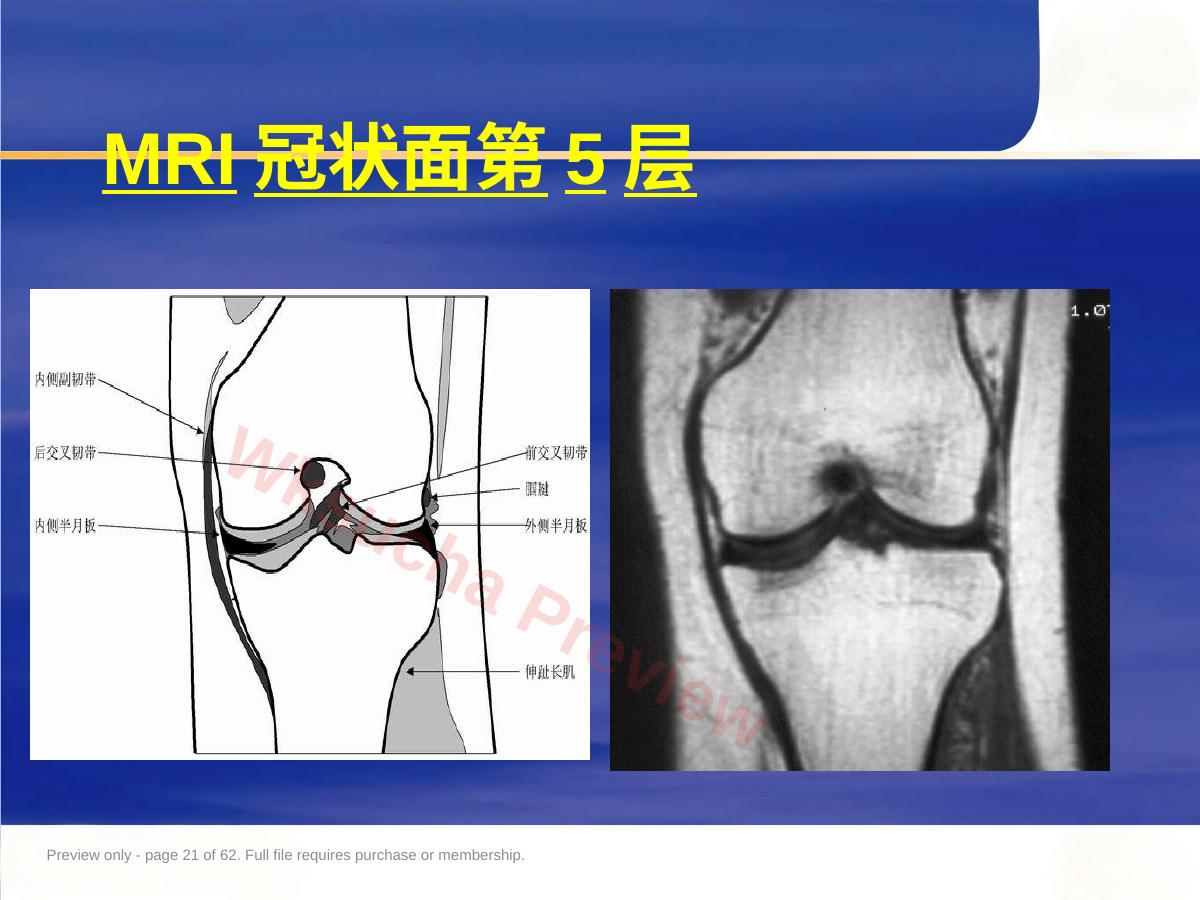 预览第 21 页
