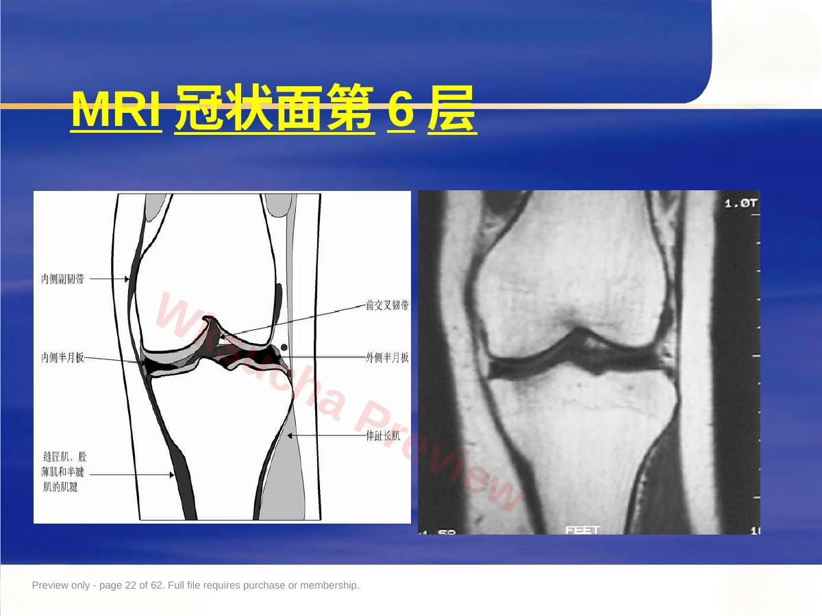预览第 22 页