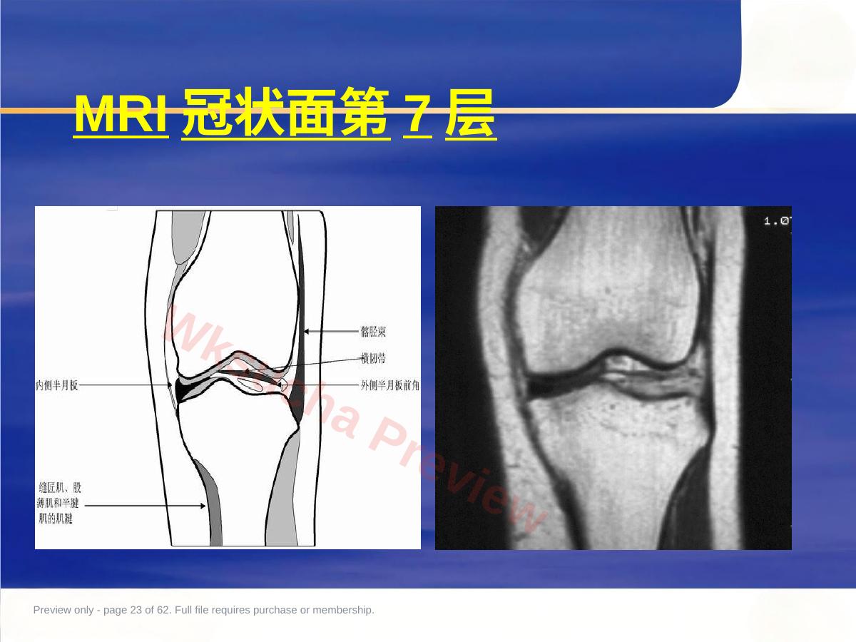预览第 23 页