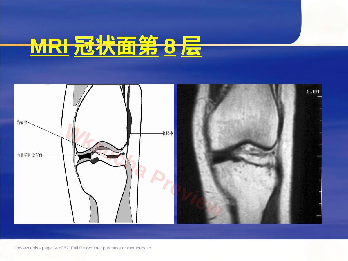 预览第 24 页
