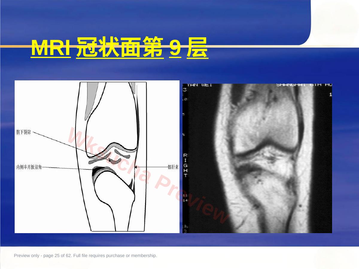 预览第 25 页