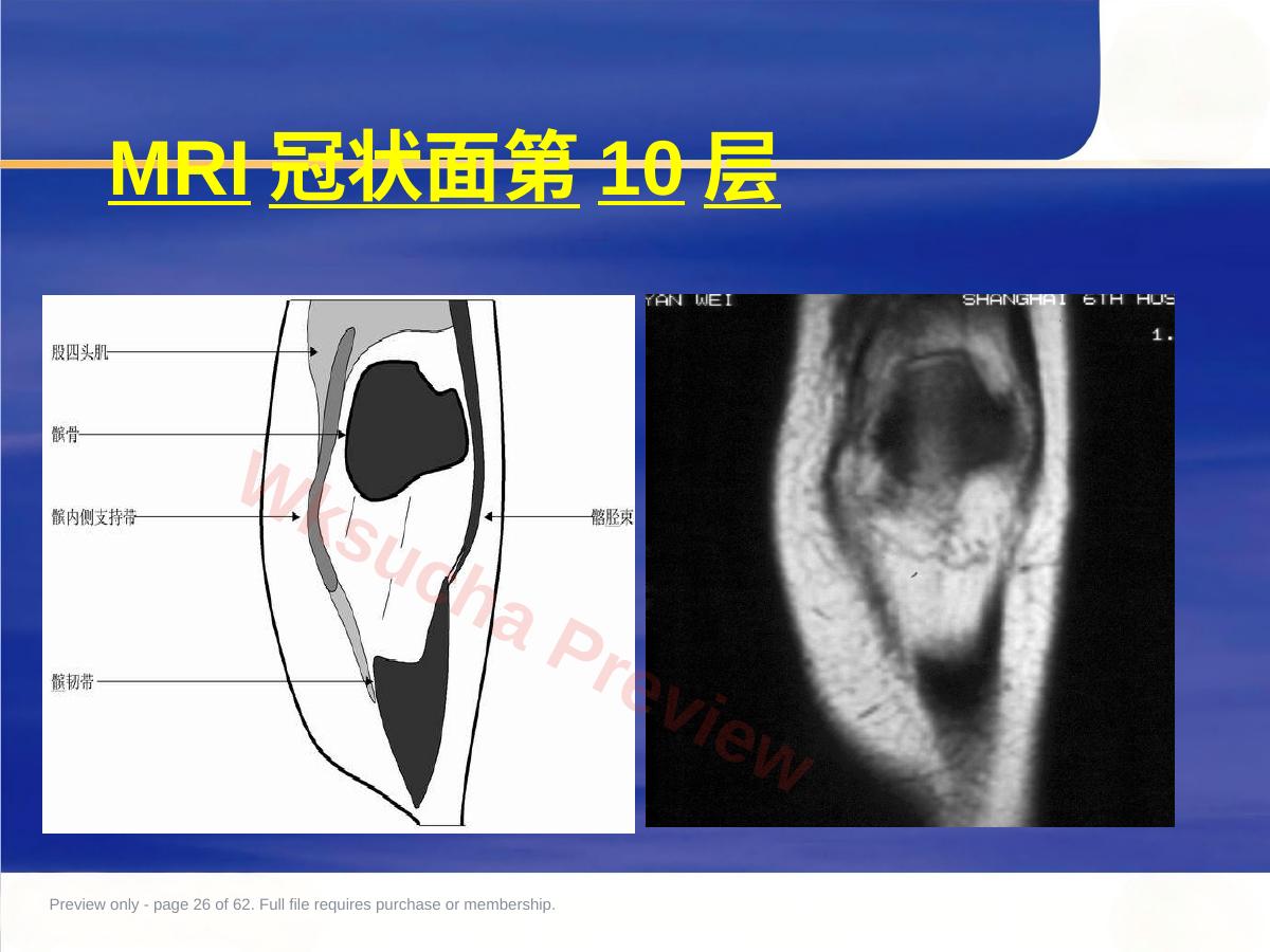 预览第 26 页