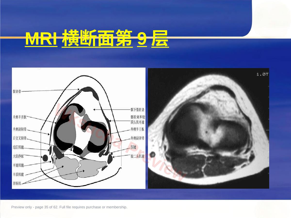 预览第 35 页