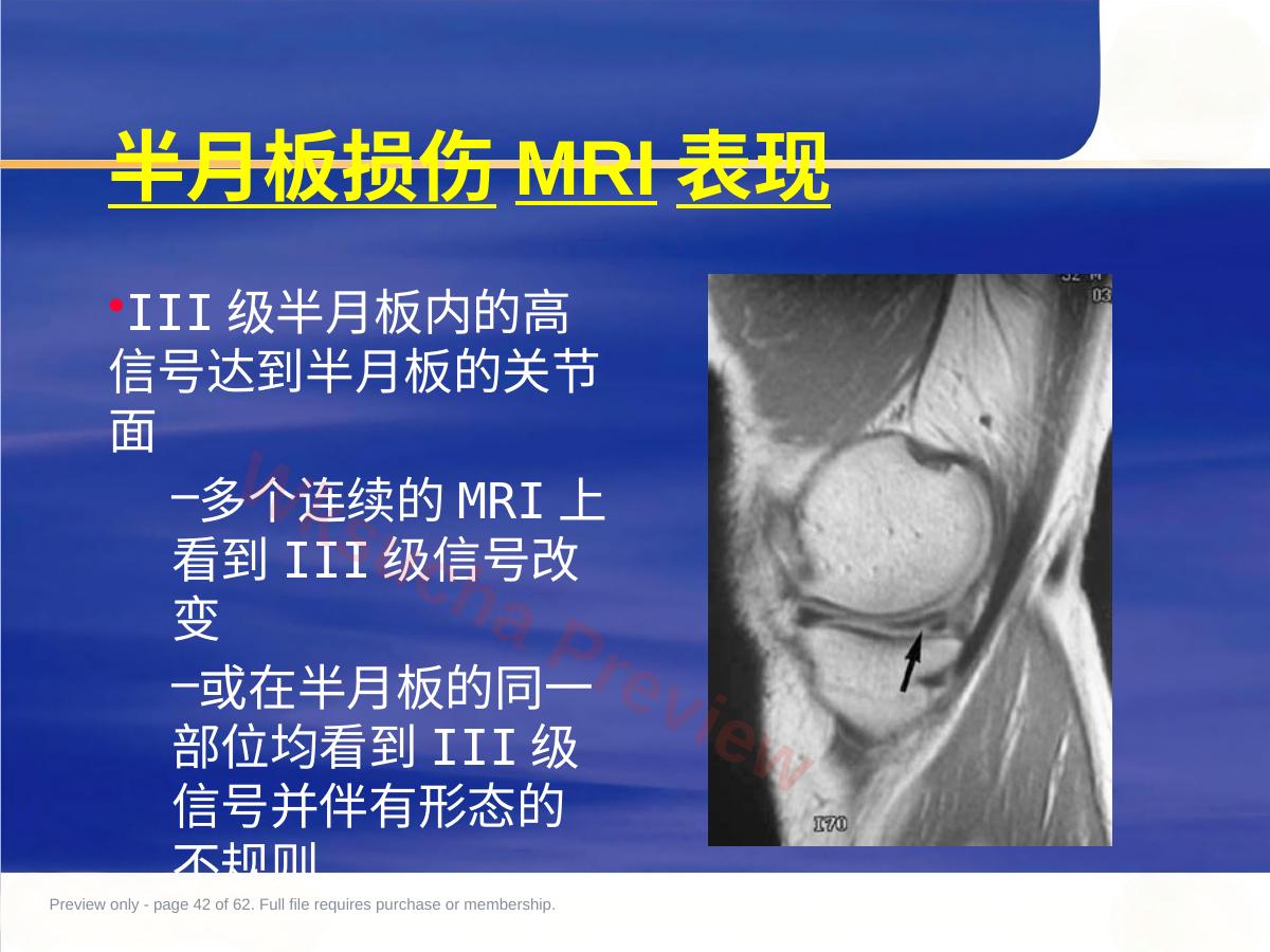 预览第 42 页