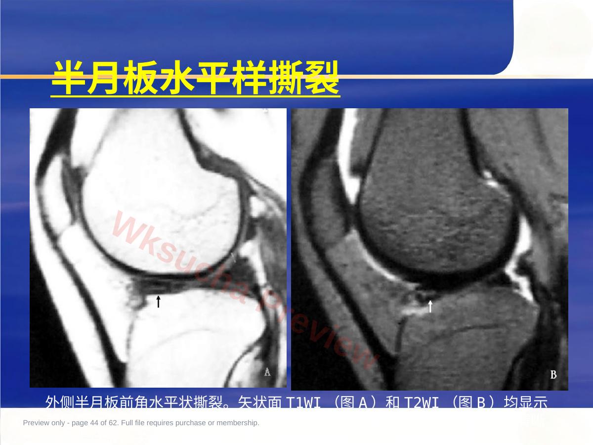 预览第 44 页