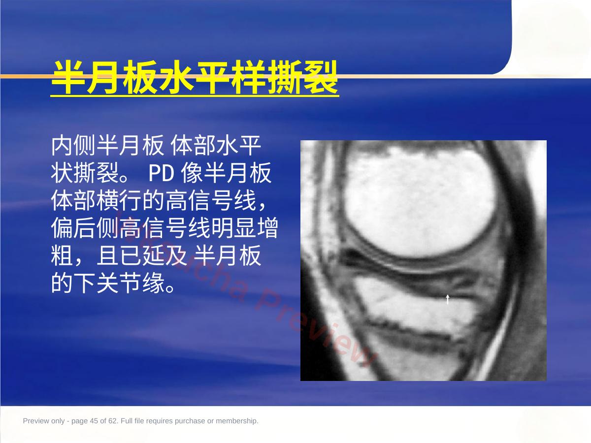 预览第 45 页