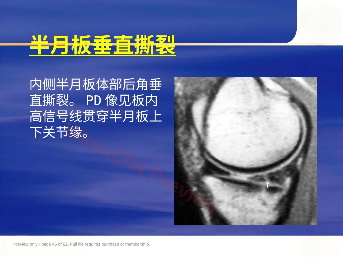 预览第 46 页