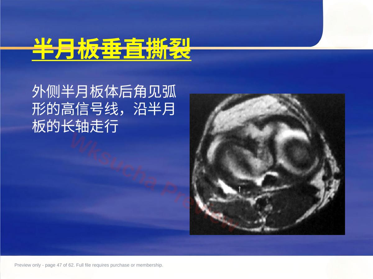 预览第 47 页