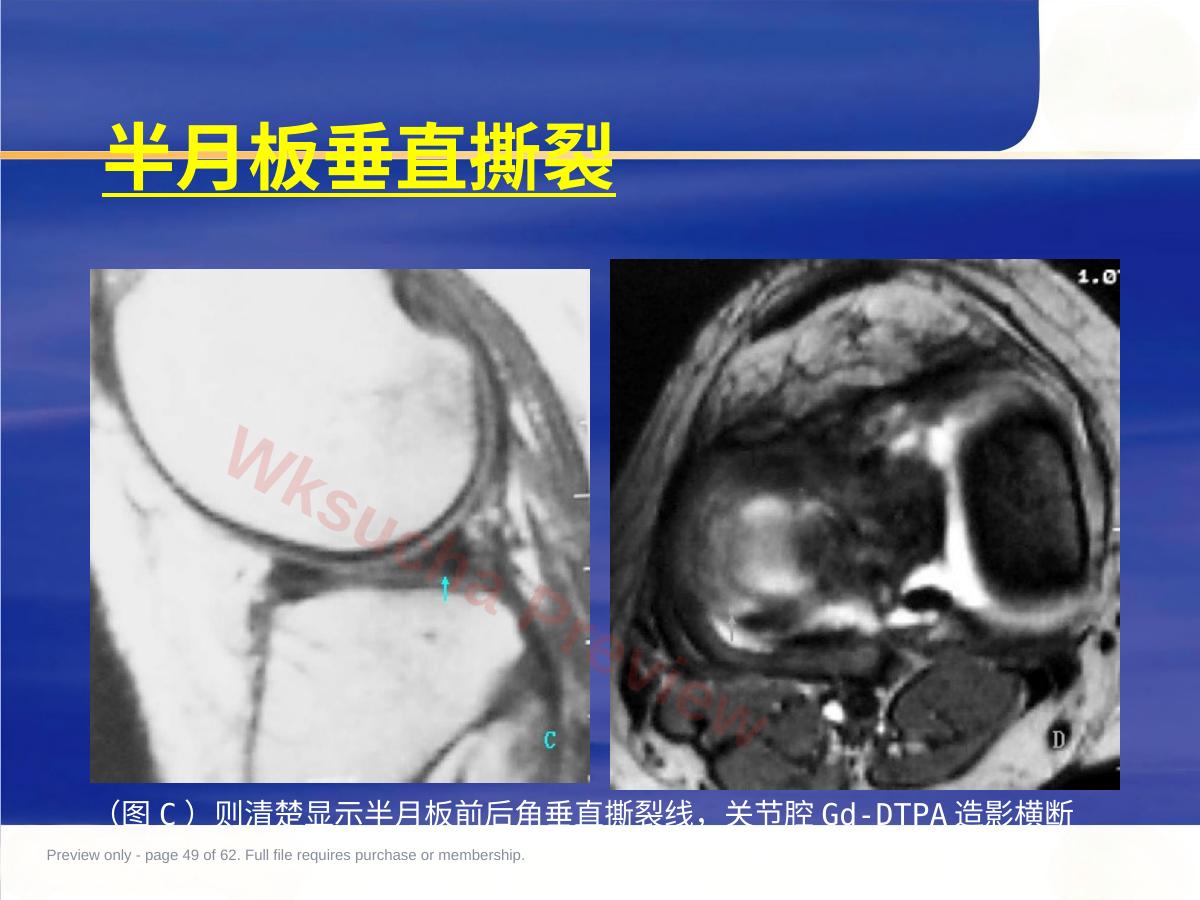 预览第 49 页