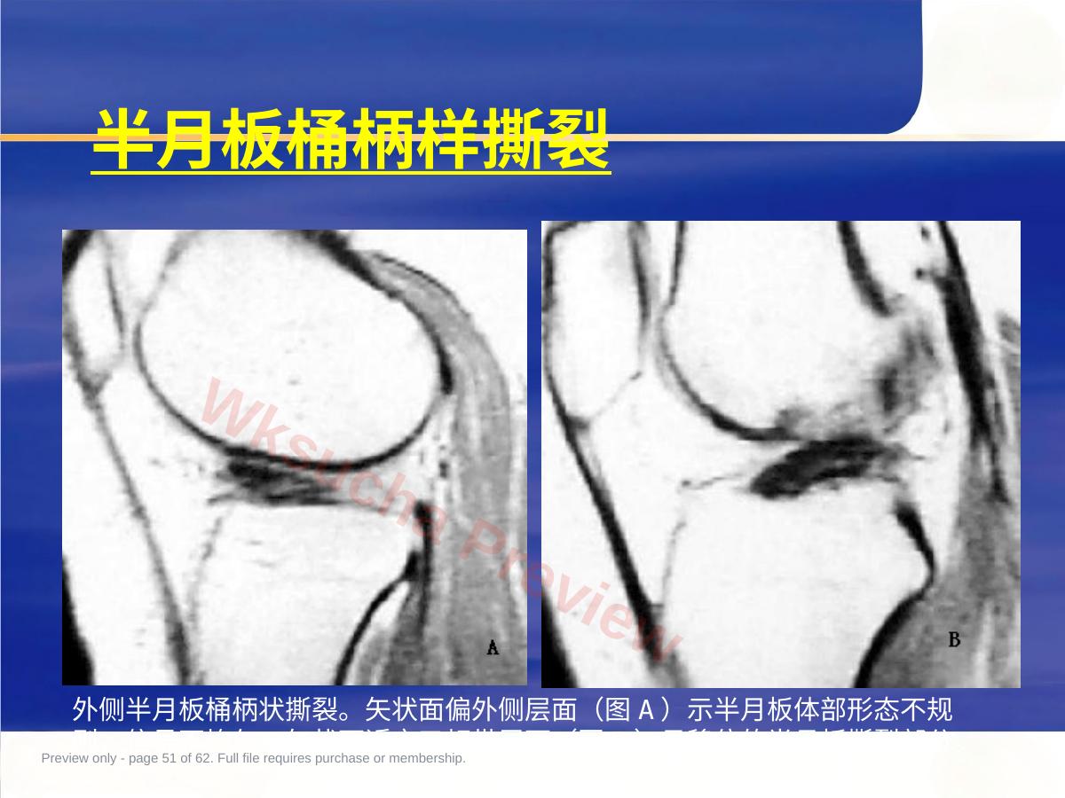预览第 51 页