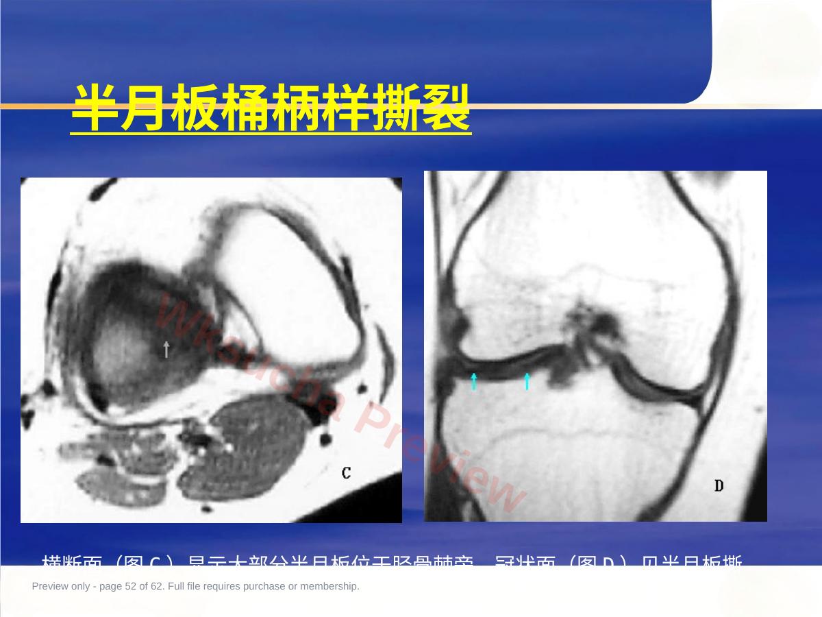 预览第 52 页