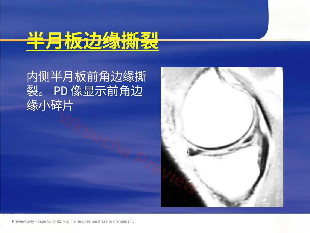 预览第 56 页