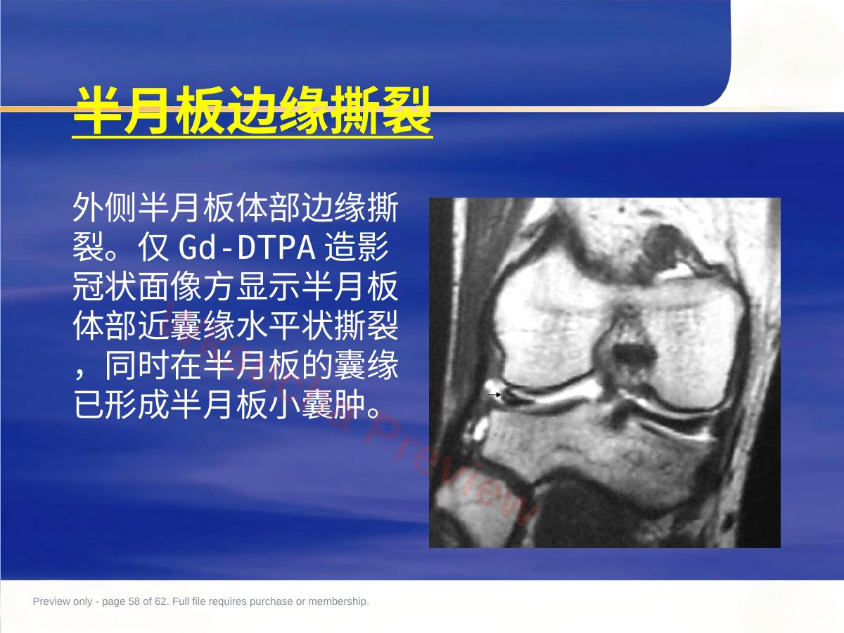 预览第 58 页