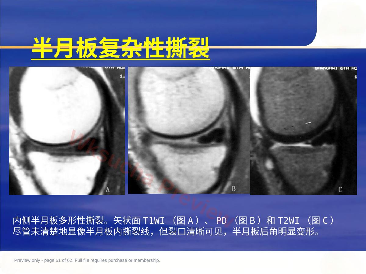 预览第 61 页