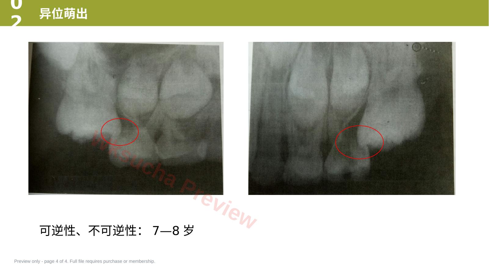 预览第 4 页