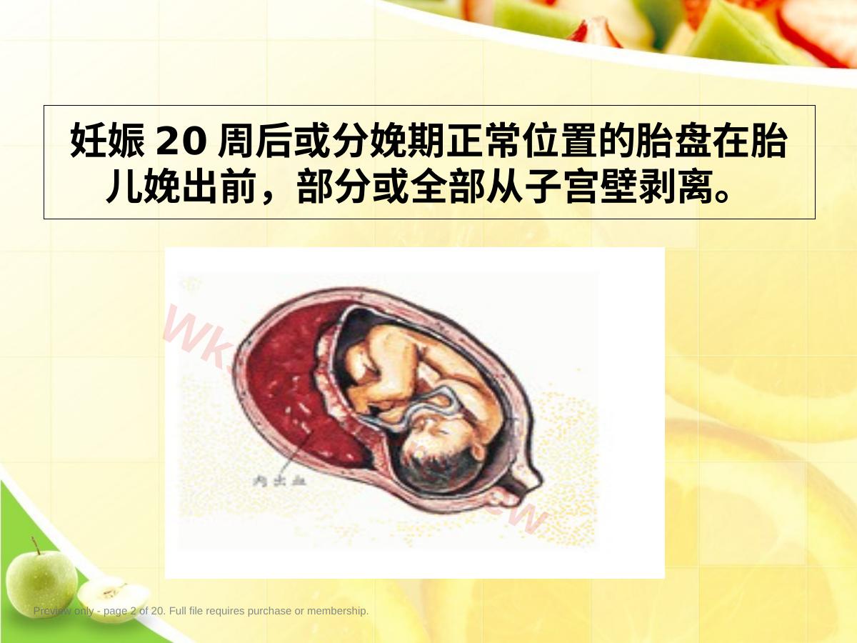 预览第 2 页