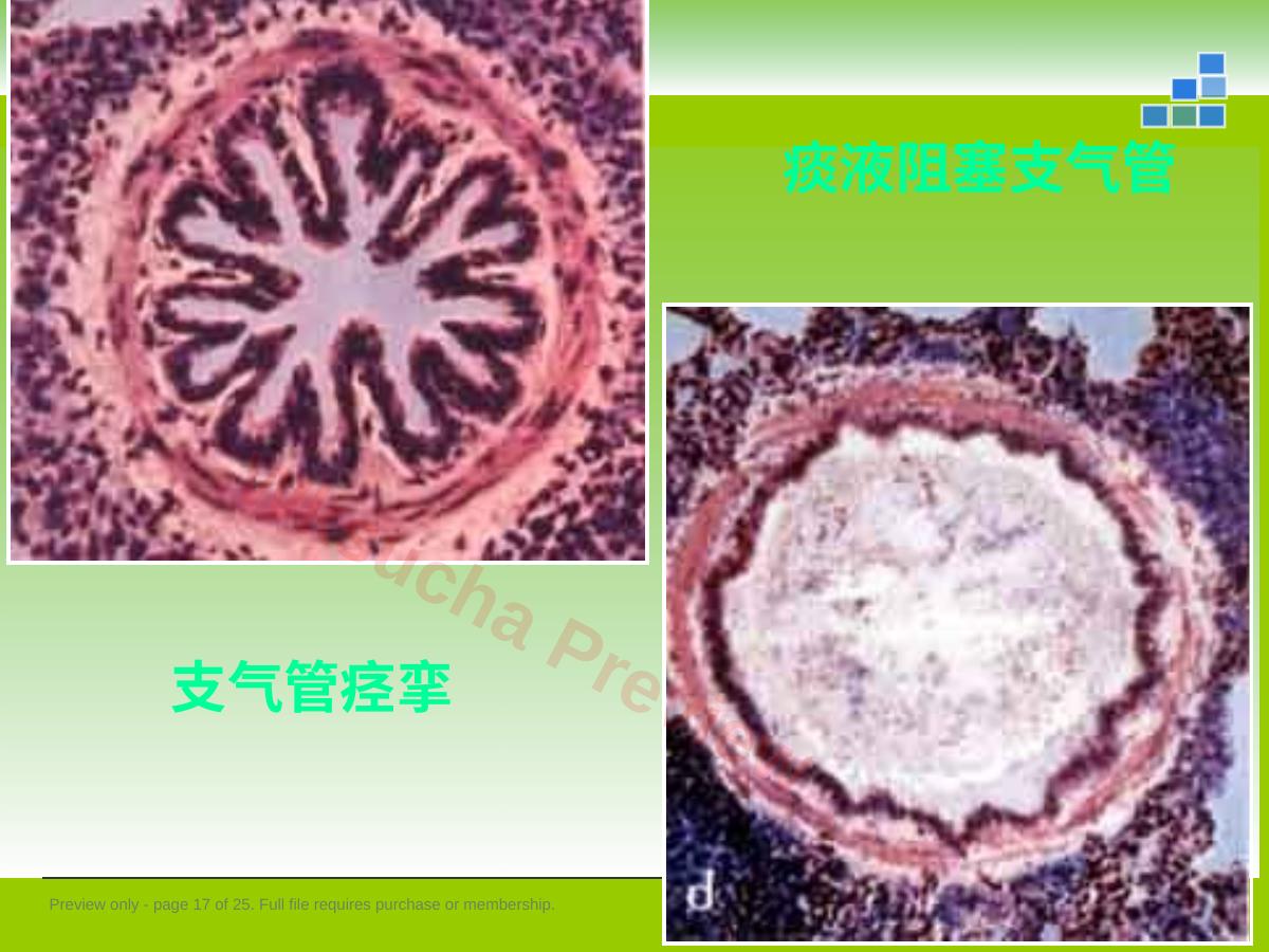 预览第 17 页